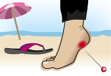 hielspoor welke schoenen